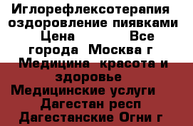 Иглорефлексотерапия, оздоровление пиявками › Цена ­ 3 000 - Все города, Москва г. Медицина, красота и здоровье » Медицинские услуги   . Дагестан респ.,Дагестанские Огни г.